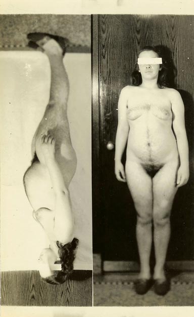 Photo of naked patient